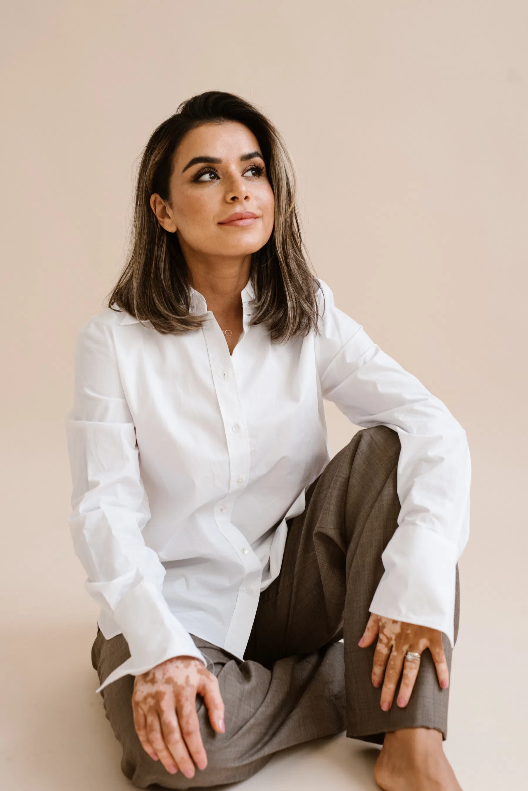 Hayeda Abbasi staat op de foto, haar vitiligo op haar handen en voeten is zichtbaar.