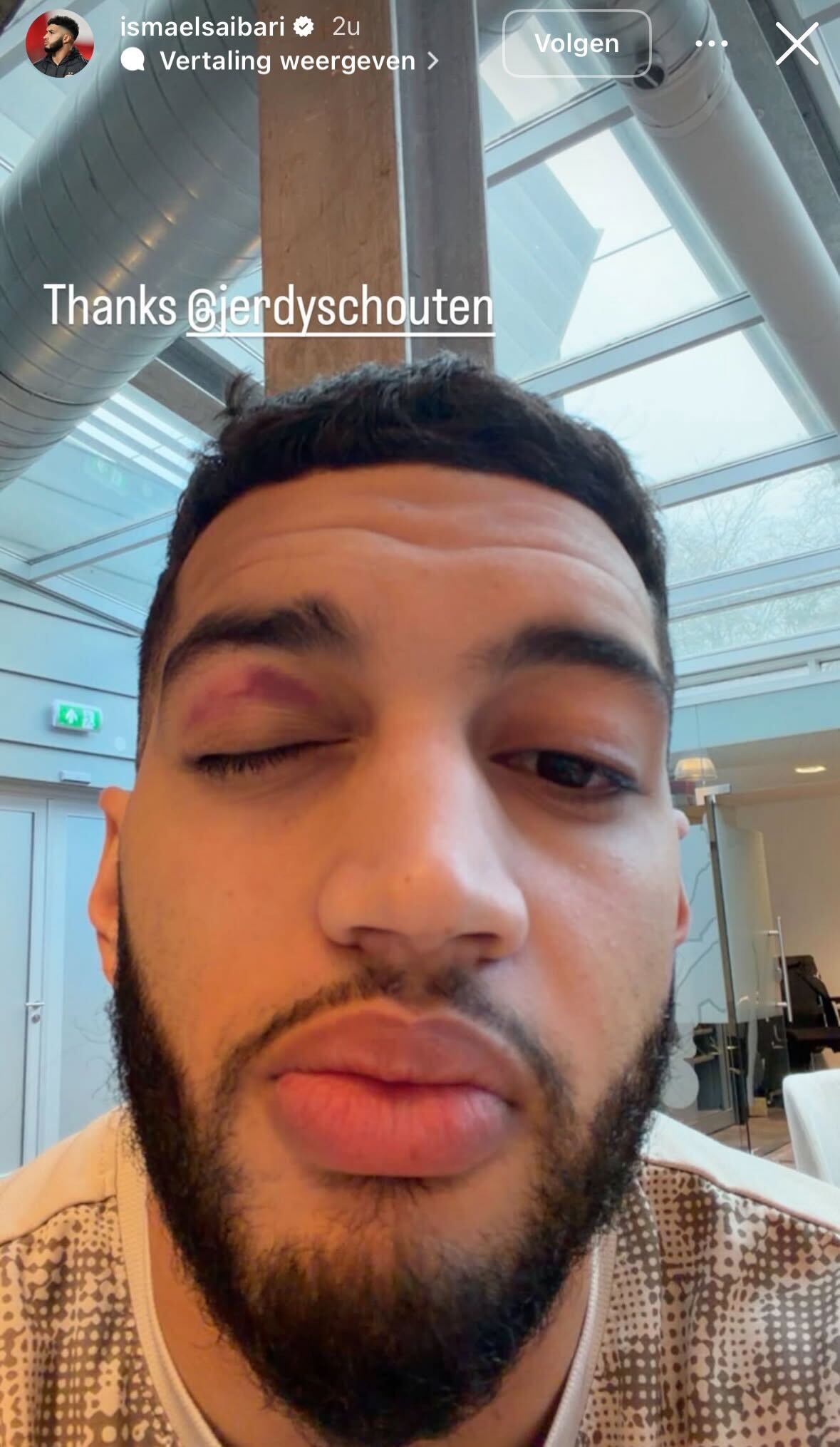 Ondersteunend beeld bij het artikel