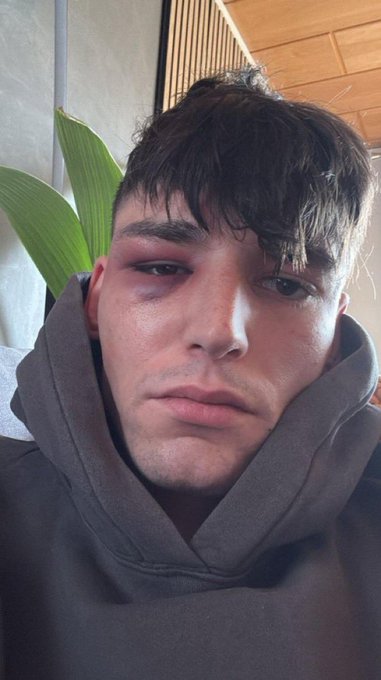 Ondersteunend beeld bij het artikel