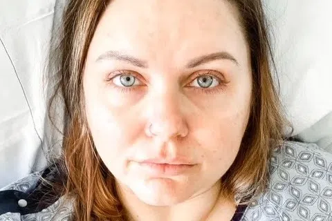 Heather kreeg de diagnose idiopathische intracraniële hypertensie