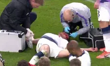 Thumbnail for article: Nare beelden uit Londen: Vertonghen van de wereld na botsing met Alderweireld