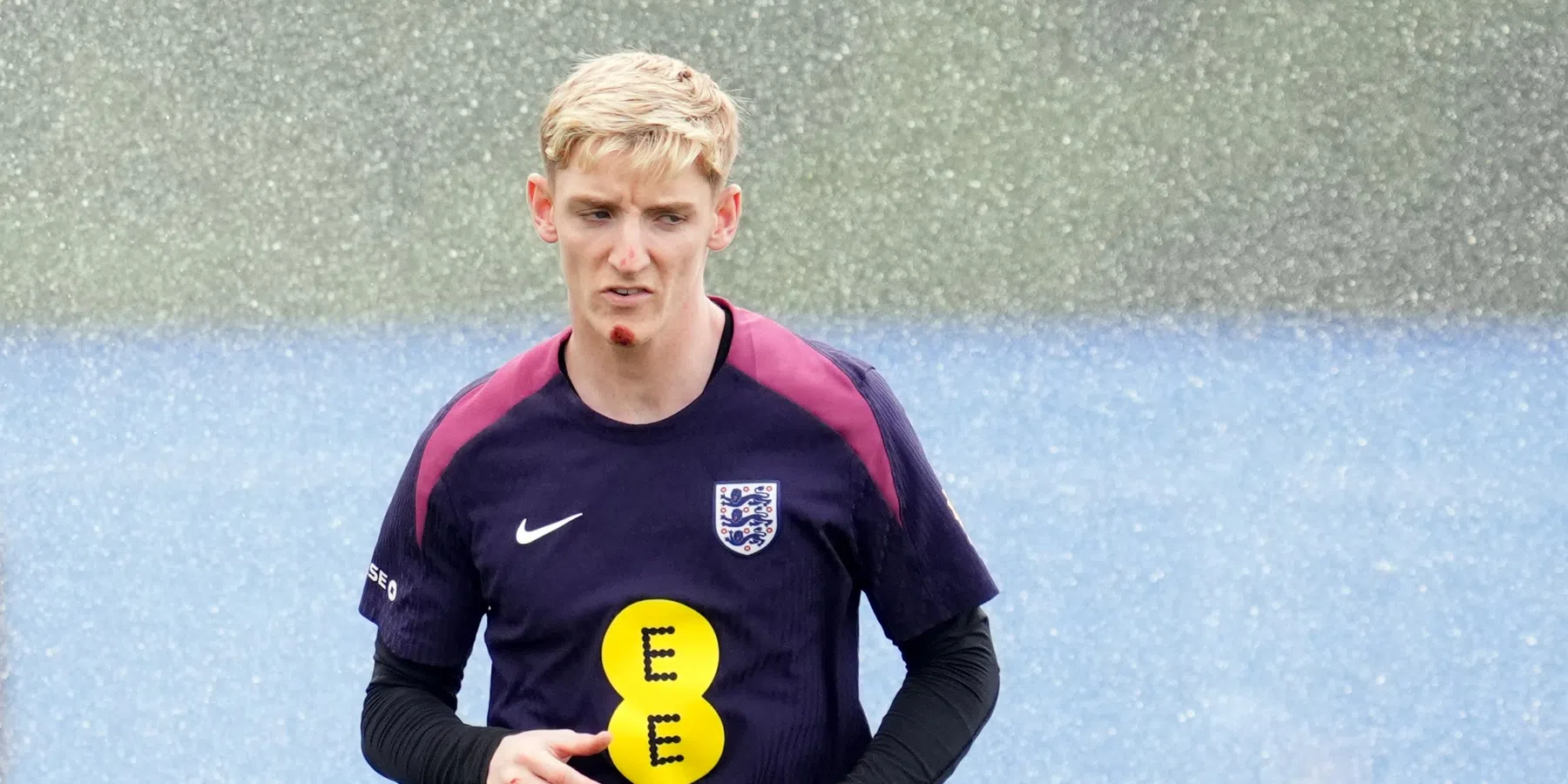 Schrikmomentje voor Engeland: Gordon verschijnt gewond op training